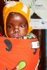 The free clinic was conducted by volunteers from Help a Child Face Tomorrow organisation at the Mwingi hospital. This child born with a cleft lip was one of the beneficiaries of the free correction surgery conducted by HCFT (Fridah Mutune, News24 user)