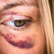 'Abuse is abuse': Legal expert shares 5 types of abuse and how to spot the signs