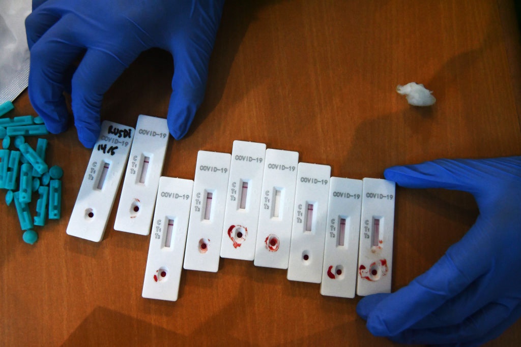 Health workers conduct Covid-19 rapid diagnostic tests.