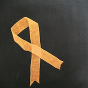 Endometriosis: condition with no cure or known cause affects millions of women globally 