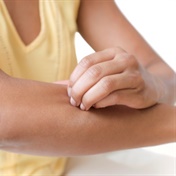 5 ways to soothe itchy skin