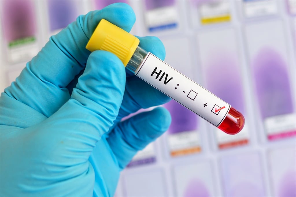 Blood sample positive with HIV test. Picture: iStock