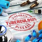 High death rate among TB patients of major concern to health department