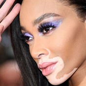 Winnie Harlow alters her makeup routine for changing vitiligo