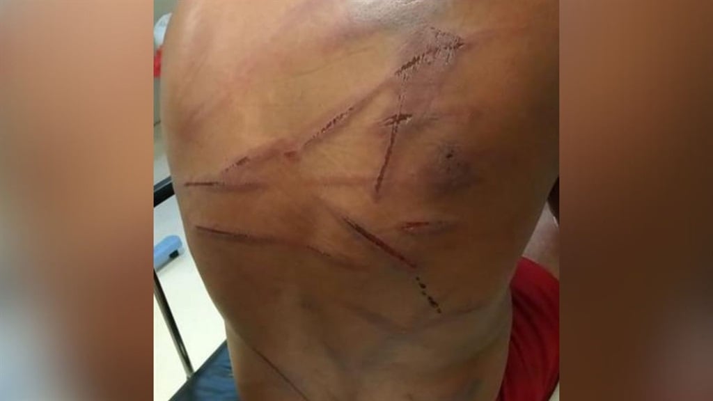 The injuries Sergeant Qhamani Welfare Maninjwa sustained after being beaten with a sjambok and knobkerrie. 