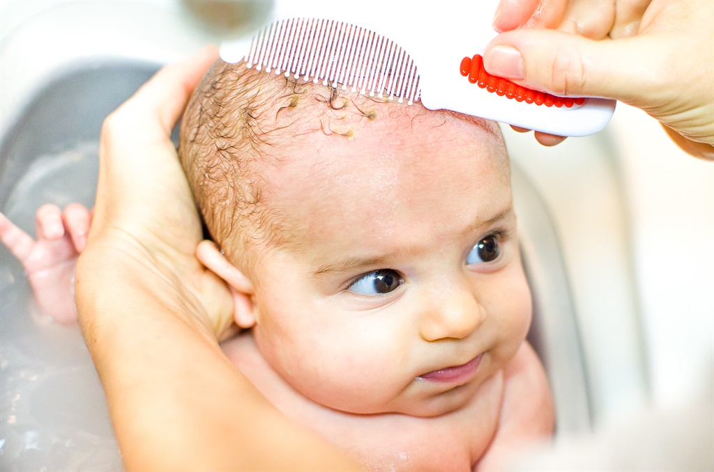 What should you be doing about cradle cap? 