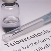TB treatment time cut by a third