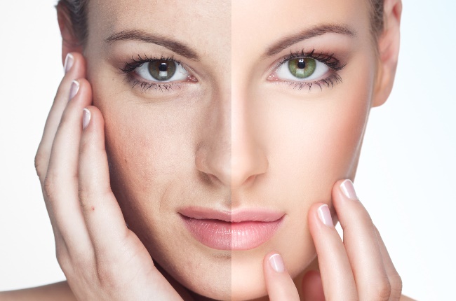 Side by side of pigmentation versus flawless skin. (PHOTO: GALLO IMAGES/GETTY IMAGES)