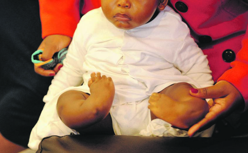 Mnqobi was born with bilateral tibial hemimelia, a rare congenital lower limb deformity that affects one in1 million newborns. Picture: Tebogo Letsie 
