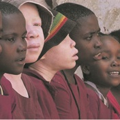 ‘People living with albinism are human beings too’