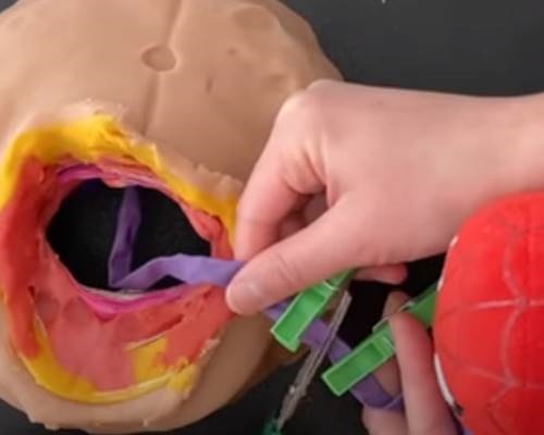 Watch | Four-year-old performs Playdough c-section