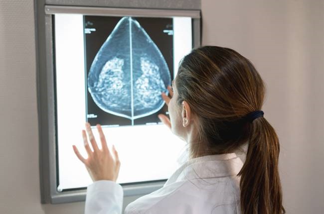 A new study looked at the differences between the breast tissue of black and white women to determine why breast cancer is more aggressive in black women.