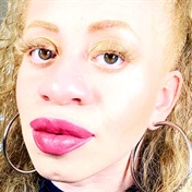 In a bid for more representation, these lashes were made specifically for people with albinism