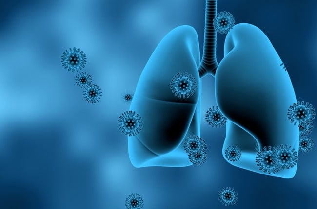 Covid-19 has been seen to cause lung damage in some patients, even post-infection.