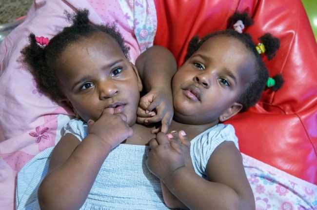 The twins were born in Senegal where doctors gave 