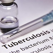 Department of health releases SA’s first TB prevalence survey