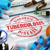 People with highly drug-resistant TB to get new three-drug regimen