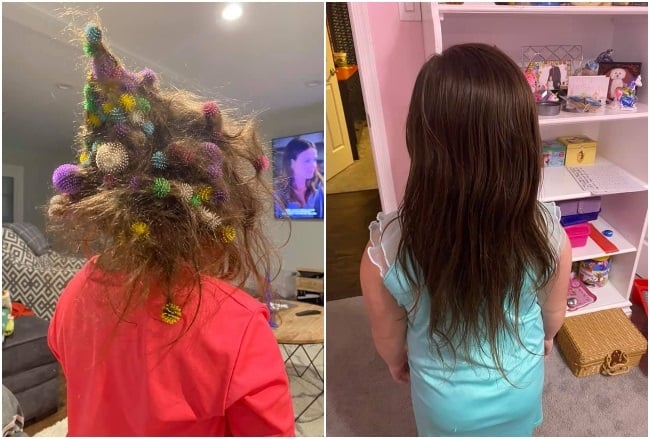 It took 20 hours to remove all the Bunchems toys from six-year-old Abigail Hoelzle's hair. (Photo: Facebook) 