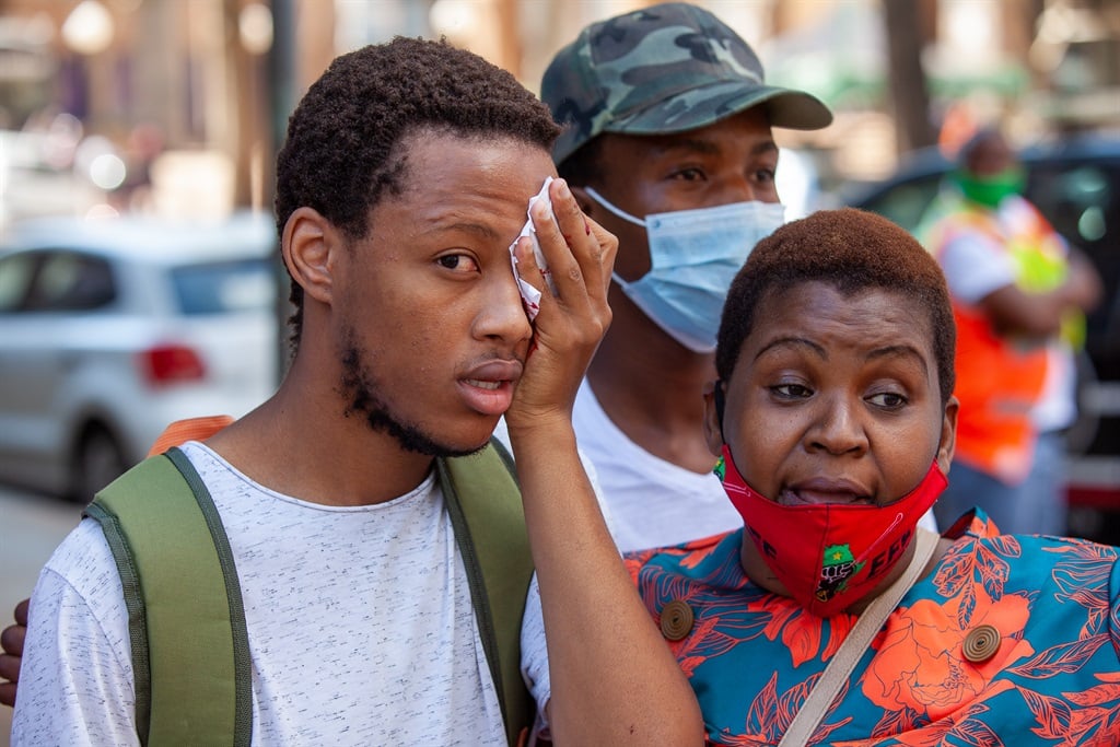 An alleged student holds a cloth over his eye after being shot with a rubber bullet during a protest at Wits University. 