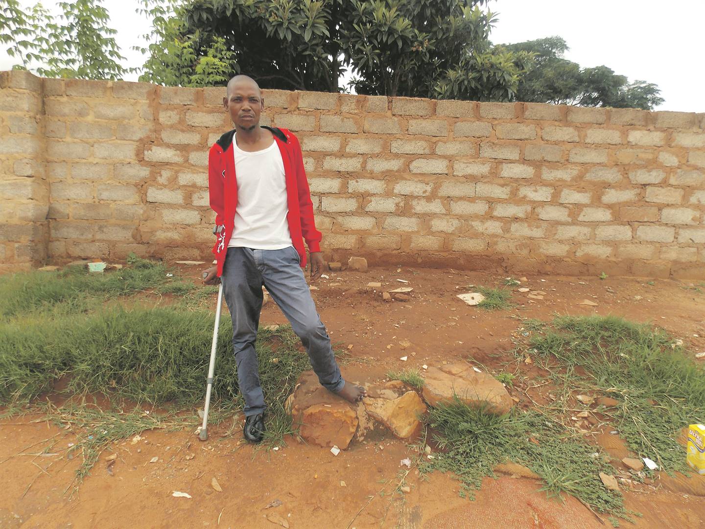 Siphiwe Kgasago is using a crutch to walk after his toes began to hurt.          Photo by Aaron Dube