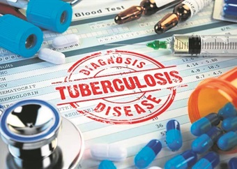 OPINION | To end TB, we need to provide vulnerable people with food