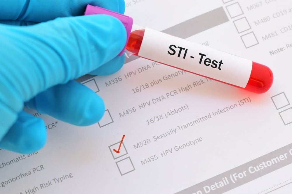 The diagnosis of Male Urethritis Syndrome is an indicator of newly acquired STIs, in particular gonorrhoea and chlamydia, which according to the Gauteng Department of Health are the most prevalent STIs in South Africa. 