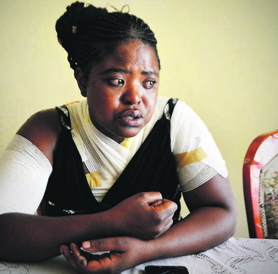 TORTURE: Salamina Hlumbane was burnt with acid, allegedly by her mastandi.       Photo by Lucky Morajane