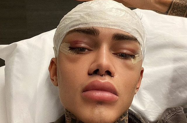 No filter? No problem. Levi Jed Murphy from Manchester, UK had surgery to look like an Instagram filter. (Photo: Instagram_ Levijedmurphy)