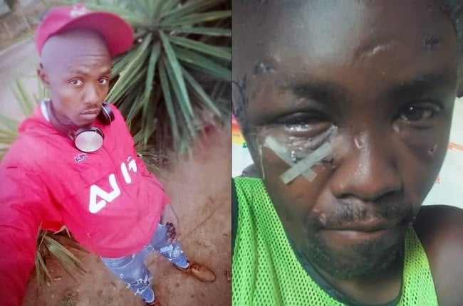 Asanda Ndlebe was severely injured when he defended a woman from being raped.