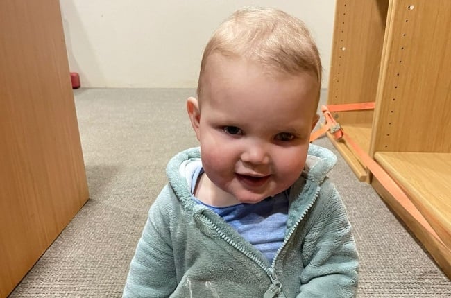 At just nine months old baby AJ Croxford underwent a ground-breaking procedure that saved his eye. (Photo: Supplied) 