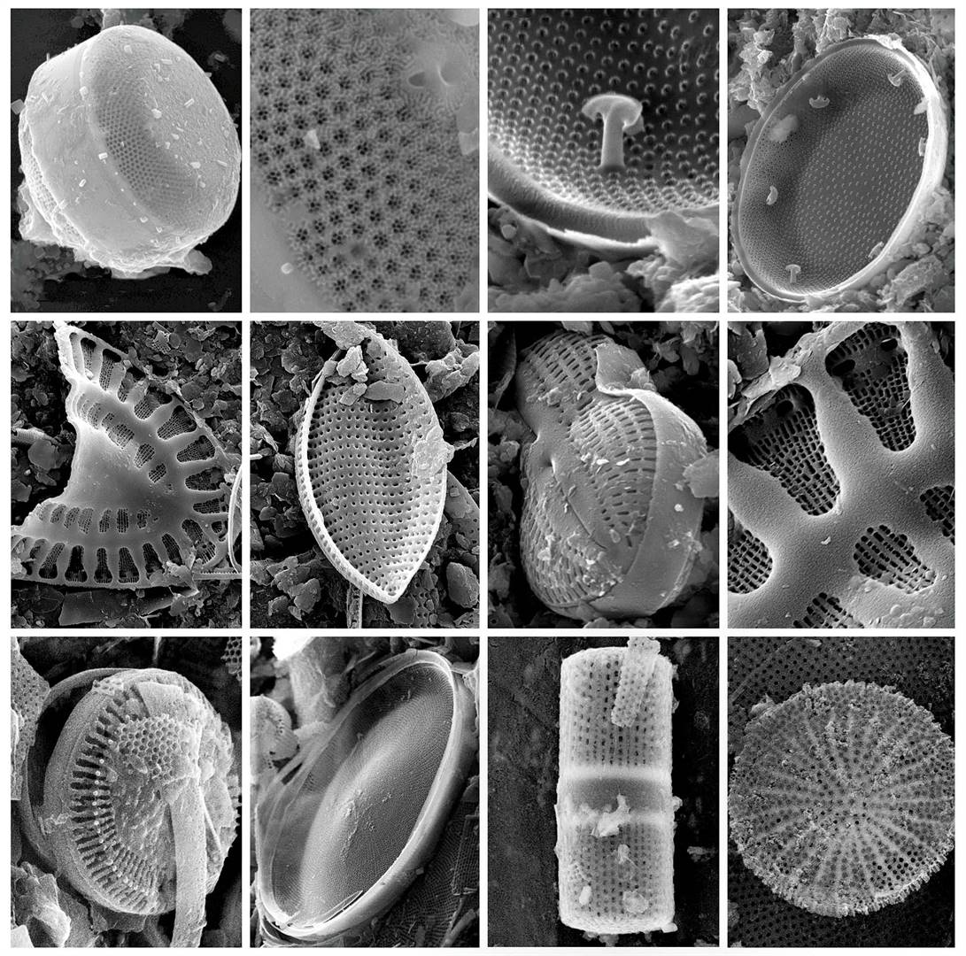 Navorsers is van mening dat die amorfe kristalstruktuur van diatome meganies werk om parasiete by vee seer of dood te maak. FOTO: JOHAN IZAK MARITZ