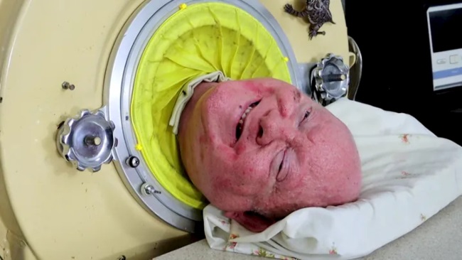 Paul Alexander, who used an iron lung to breathe for 72 years, has passed away. (PHOTO: Gofundme.com)
