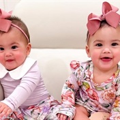 Formerly conjoined twins celebrate their first birthday after being separated 