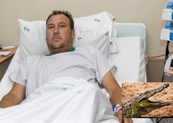 Wife’s quick thinking saves Middelburg man from the jaws of a crocodile