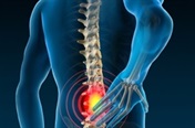 FAQs about back pain