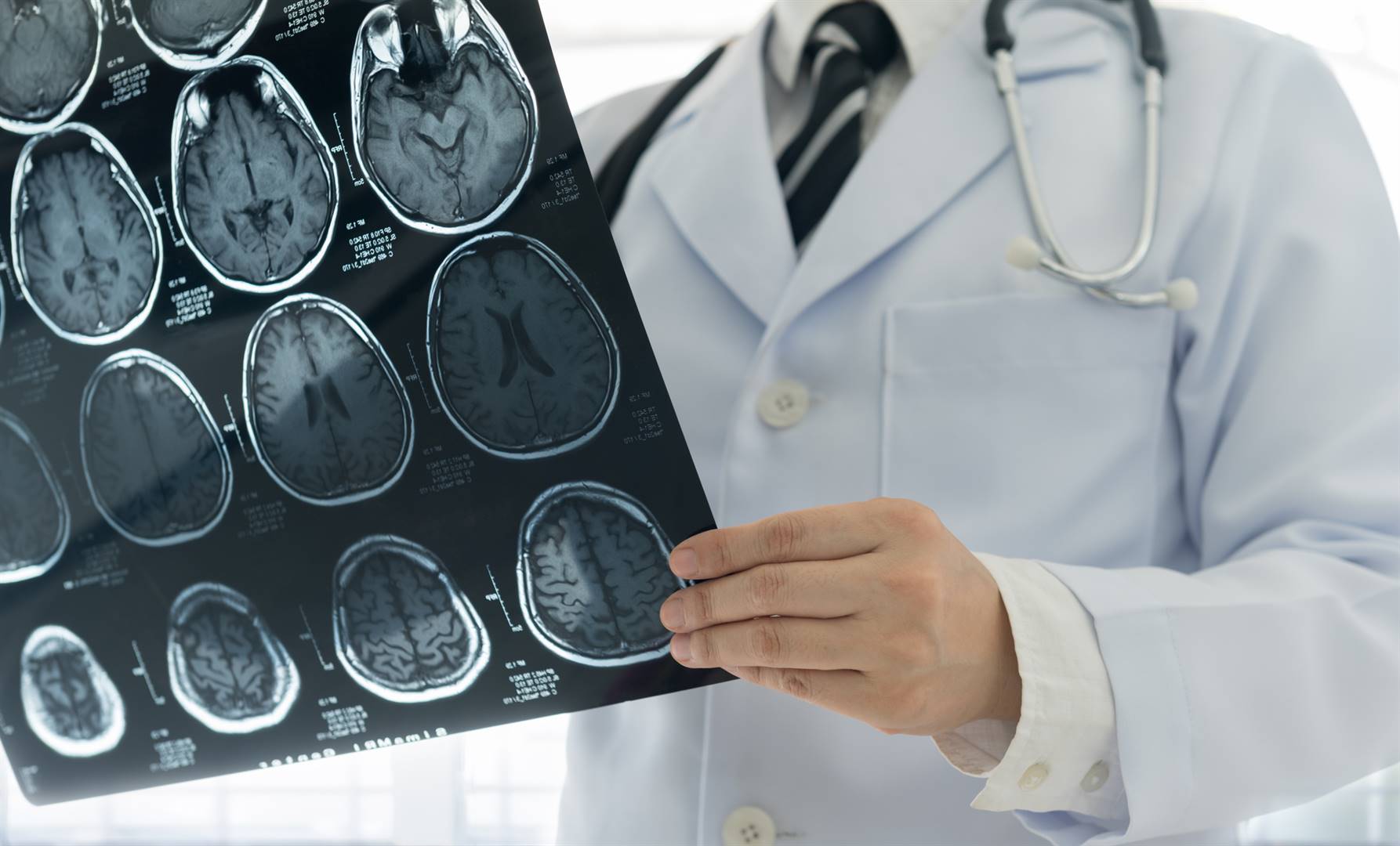 All images such as X-rays, CT scans and MRI scans are stored on the picture archiving and communication system which was unavailable at Charlotte Maxeke from October 1. Photo: iStock