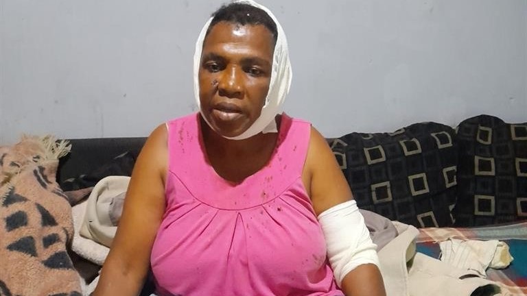 Nonhlanhla Msibi was attacked by a councillor's two pitbulls. Photo by Sammy Moretsi