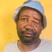 Limpopo  man on horror hyena attack: ‘ I realised something was eating me right there and then’