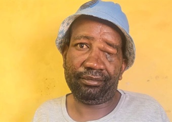 Limpopo  man on horror hyena attack: ‘ I realised something was eating me right there and then’
