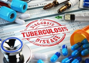 Faster tests, shorter treatments: How new tech could help slow down drug-resistant TB