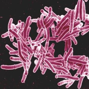 TB bacteria - Google Free Images