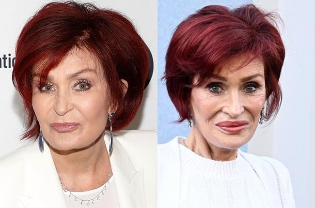 semaglutide red face A willow-limbed body with an aged face, thanks to Ozempic