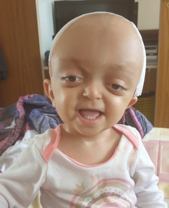 The one-year-old is recovering well after the cran