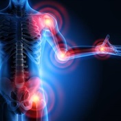Study finds persistently osteoarthritis burden worldwide