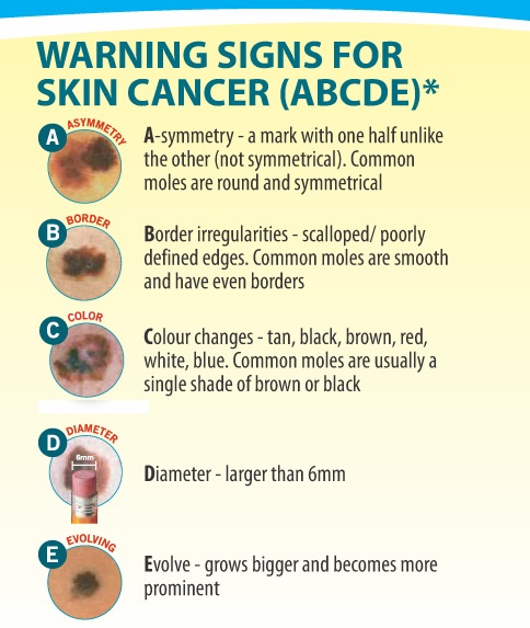 skin cancer warning signs