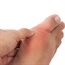 Myths about gout are hampering its treatment
