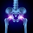 Hip replacement boosts heart attack risk
