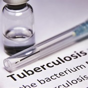 ANALYSIS | Veronica Ueckermann: Time to refocus research efforts on eradicating TB