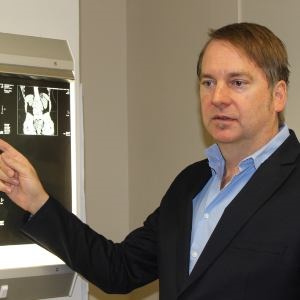 Dr Marius Conradie, a urologist at Netcare Waterfall City Hospital, who removed the 3.2kg kidney tumour. image supplied