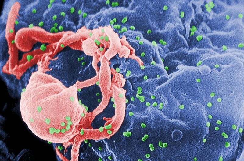 The report reveals that the human impact of stalling the progress of addressing HIV has been chilling because 650 000 people died of Aids-related causes last year. Photo: CDC/public domain